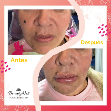 Slider image (6) NES Regenerative Medicine Clinic